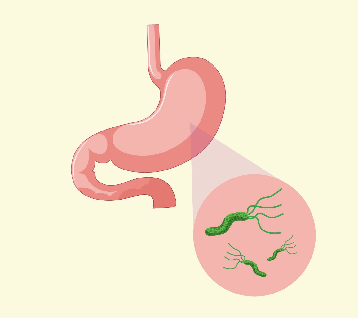 Berberina para Bacteria HP y+ 5 Una Solución Natural para la Salud Gastrointestinal